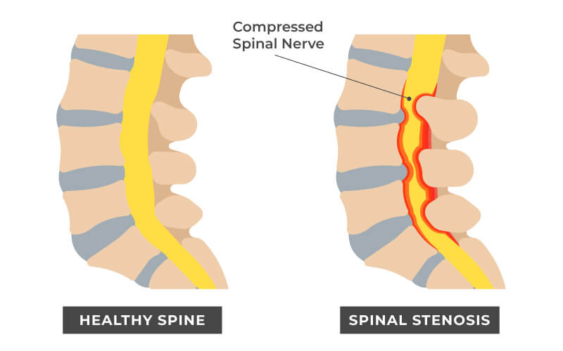 Chiropractic For Neck Pain: Does It Work? 